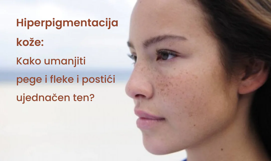 Blog slike 11